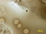 Ureaplasma diversum under the microscope. Photo: Dr Kapil Chousalka