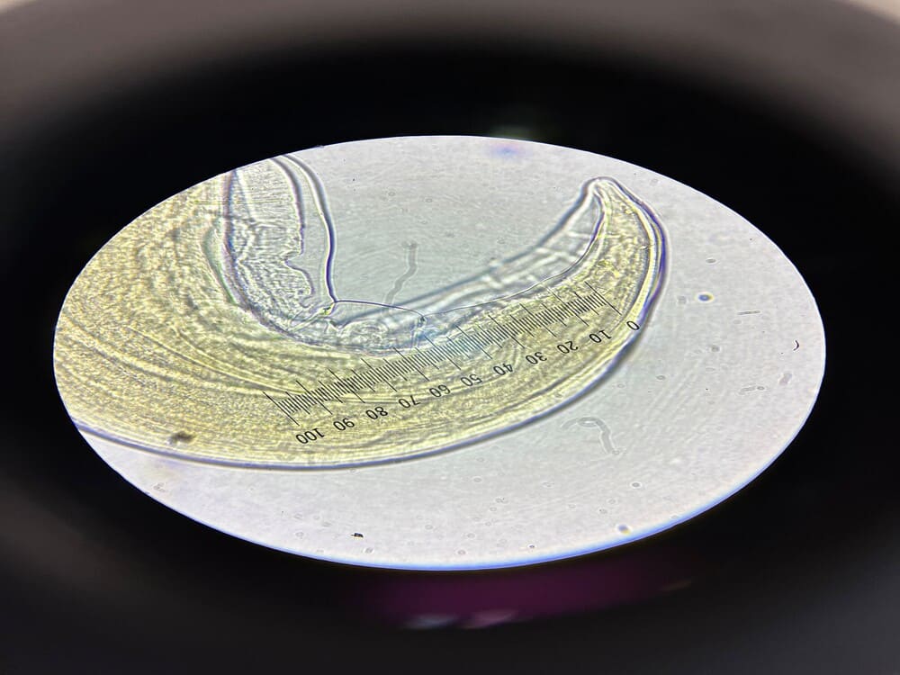 parasite under microscope