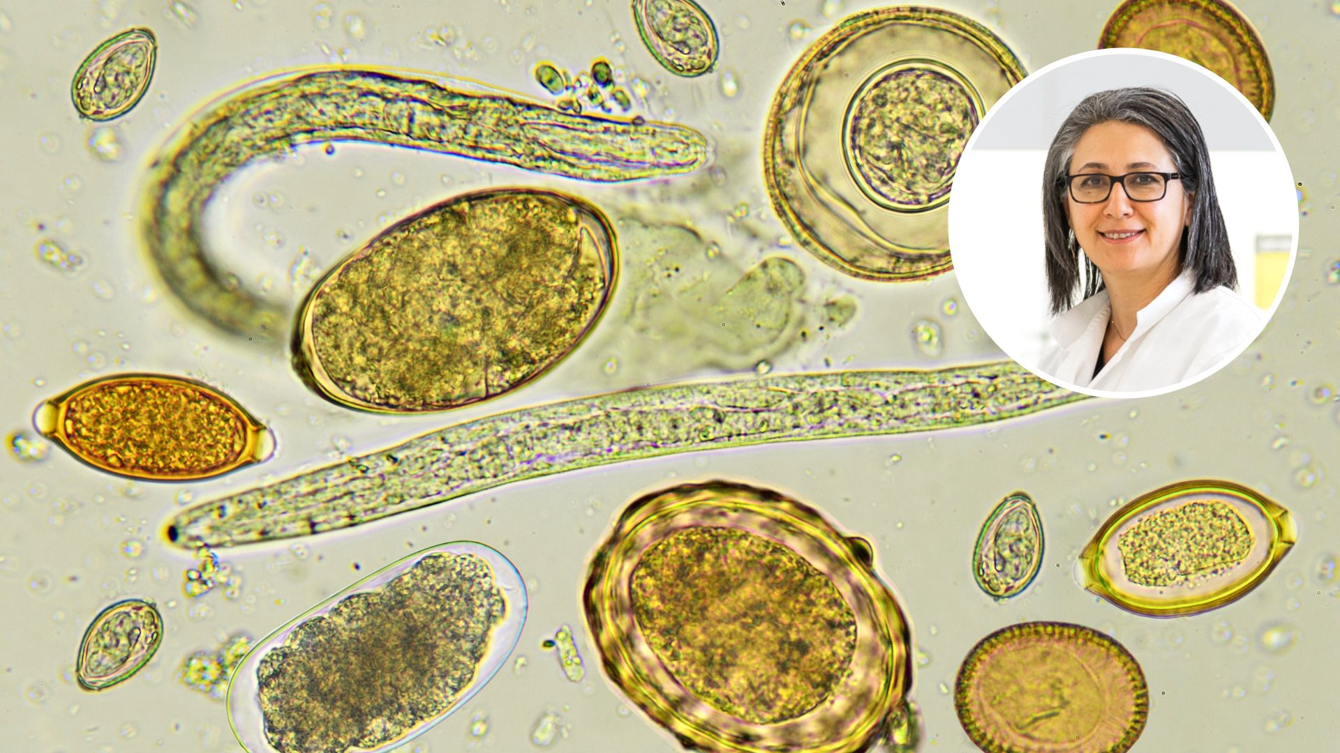 Charles Sturt scientist contributes to the UN expert panel on foodborne parasites